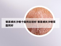 银屑病长沙哪个医院比较好 银屑病长沙哪家医院好