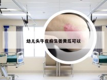 幼儿头牛皮癣生姜黄瓜可以