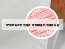 宝宝眼角有白斑图片 宝宝眼角白斑图片大全