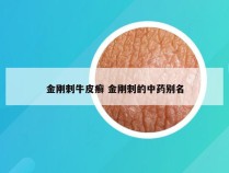 金刚刺牛皮癣 金刚刺的中药别名