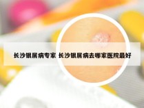 长沙银屑病专家 长沙银屑病去哪家医院最好