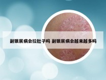 副银屑病会拉肚子吗 副银屑病会越来越多吗