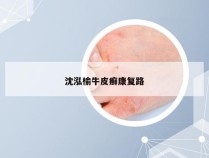 沈泓榆牛皮癣康复路