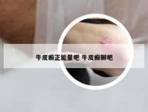 牛皮癣正能量吧 牛皮癣聊吧