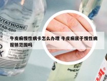 牛皮癣慢性病卡怎么办理 牛皮癣属于慢性病报销范围吗