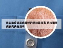 光头治疗银屑病最好的医院是哪家 头皮银屑病剃光头有用吗