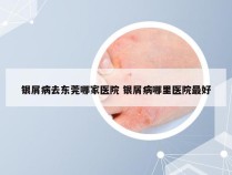 银屑病去东莞哪家医院 银屑病哪里医院最好