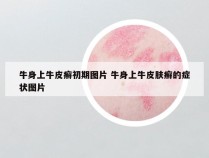 牛身上牛皮癣初期图片 牛身上牛皮肤癣的症状图片