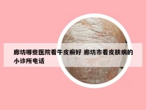 廊坊哪些医院看牛皮癣好 廊坊市看皮肤病的小诊所电话