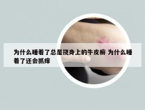 为什么睡着了总是挠身上的牛皮癣 为什么睡着了还会抓痒