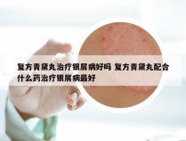 复方青黛丸治疗银屑病好吗 复方青黛丸配合什么药治疗银屑病最好