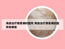 海南治疗银屑病的医院 海南治疗银屑病的医院有哪些