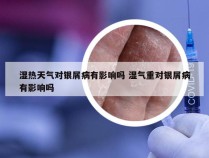 湿热天气对银屑病有影响吗 湿气重对银屑病有影响吗
