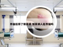 养猫后得了银屑病 银屑病人能养猫吗