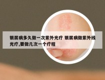 银屑病多久做一次紫外光疗 银屑病做紫外线光疗,要做几次一个疗程