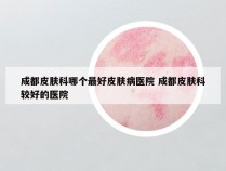 成都皮肤科哪个最好皮肤病医院 成都皮肤科较好的医院