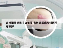 吉林银屑病挑崋山更佳 吉林银屑病专科医院哪家好