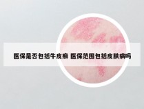 医保是否包括牛皮癣 医保范围包括皮肤病吗