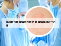 民间祖传银屑病秘方大全 银屑病民间治疗方法