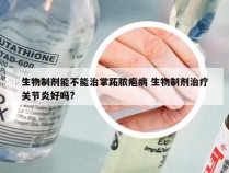 生物制剂能不能治掌跖脓疱病 生物制剂治疗关节炎好吗?