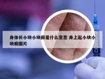 身体长小块小块藓是什么意思 身上起小块小块癣图片