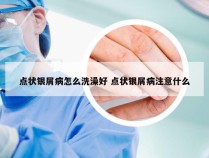 点状银屑病怎么洗澡好 点状银屑病注意什么