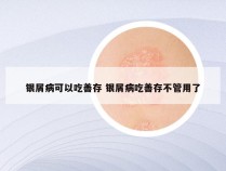 银屑病可以吃善存 银屑病吃善存不管用了
