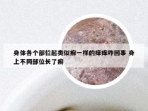 身体各个部位起类似癣一样的痒痒咋回事 身上不同部位长了癣