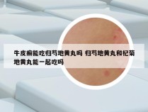 牛皮癣能吃归芍地黄丸吗 归芍地黄丸和杞菊地黄丸能一起吃吗