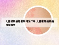 儿童银屑病患者如何治疗呢 儿童银屑病的病因有哪些