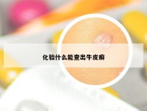 化验什么能查出牛皮癣