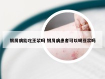 银屑病能吃王浆吗 银屑病患者可以喝豆浆吗