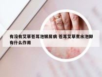 有没有艾草苍耳泡银屑病 苍耳艾草煮水泡脚有什么作用