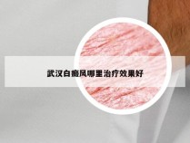 武汉白癜风哪里治疗效果好