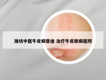 潍坊中医牛皮癣昏迷 治疗牛皮肤癣医院
