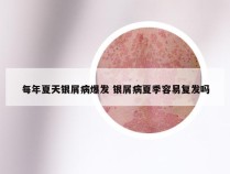 每年夏天银屑病爆发 银屑病夏季容易复发吗