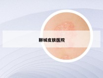 聊城皮肤医院