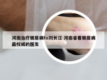 河南治疗银屑病to刘长江 河南省看银屑病最权威的医生