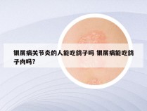 银屑病关节炎的人能吃鸽子吗 银屑病能吃鸽子肉吗?