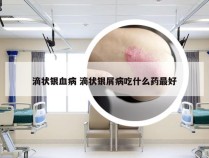 滴状银血病 滴状银屑病吃什么药最好