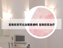 龙珠软膏可以治银屑病吗 龙珠软膏治疗