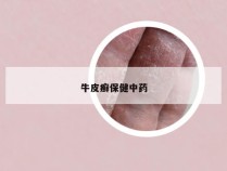 牛皮癣保健中药