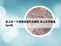 身上长一个疙瘩会是牛皮癣吗 身上长疙瘩是hpv吗