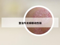 整治牛皮癣联动性弱