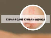 武清牛皮癣在哪看 武清区皮肤病医院检查
