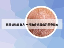 银屑病软膏复方 一种治疗银屑病的药膏配方