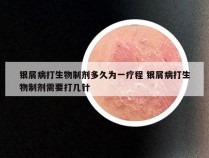 银屑病打生物制剂多久为一疗程 银屑病打生物制剂需要打几针