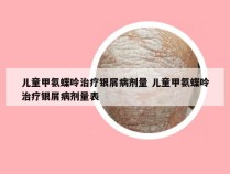 儿童甲氨蝶呤治疗银屑病剂量 儿童甲氨蝶呤治疗银屑病剂量表