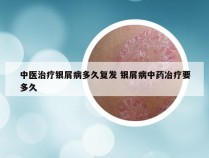 中医治疗银屑病多久复发 银屑病中药冶疗要多久