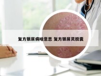 复方银屑病啥意思 复方银屑灵胶囊